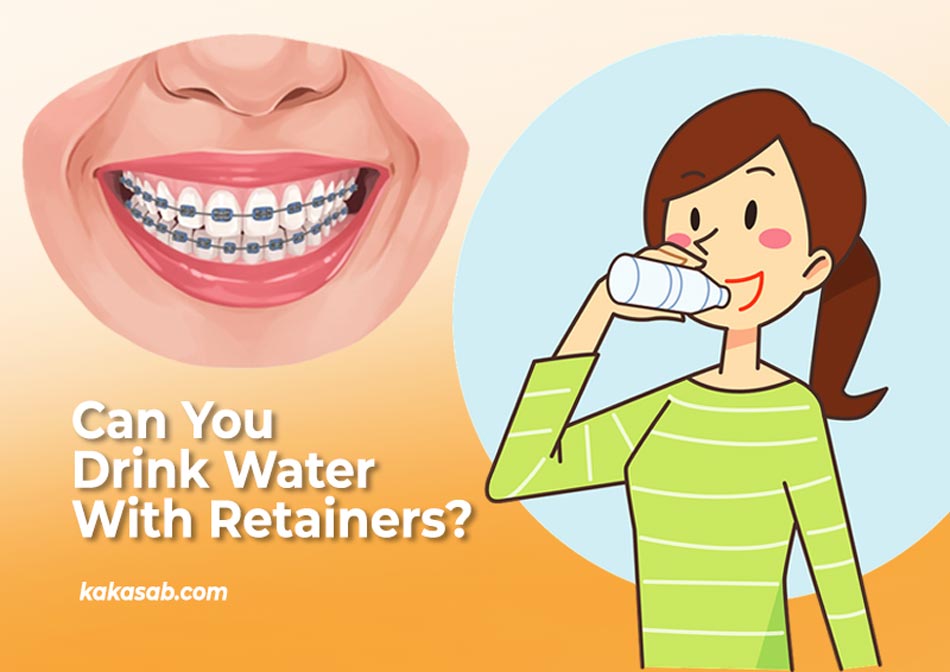 Can You Drink Water With Retainers?